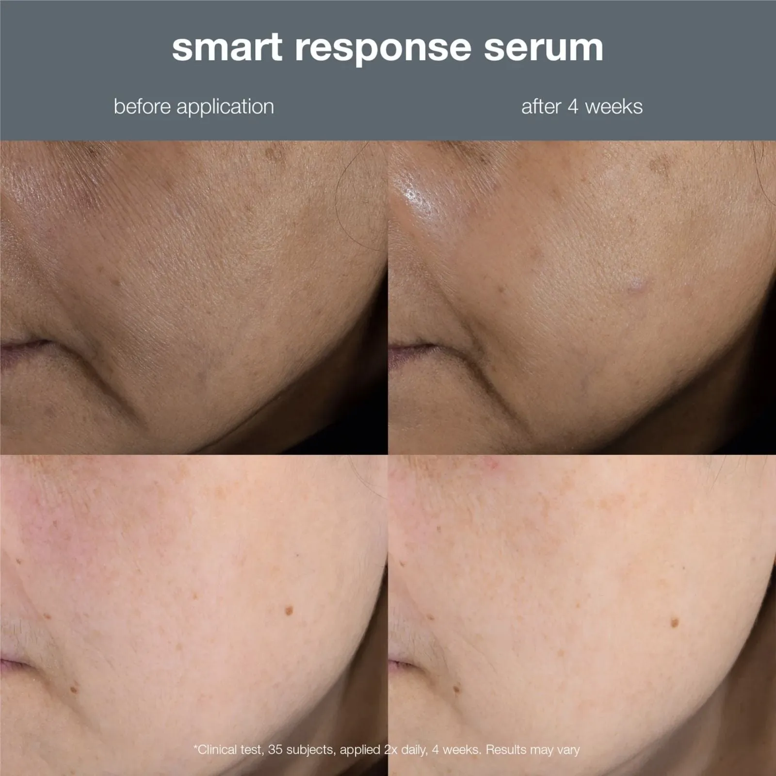 Dermalogica | Smart Response Serum 30ml