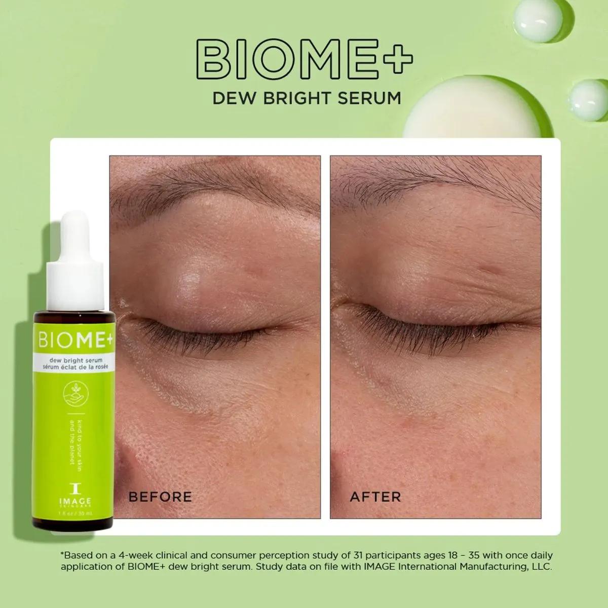 Image Skincare | BIOME+ Dew Bright Serum 30ml